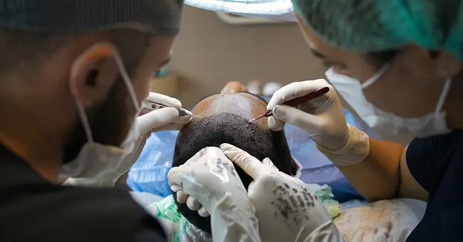hair-transplant pixabay